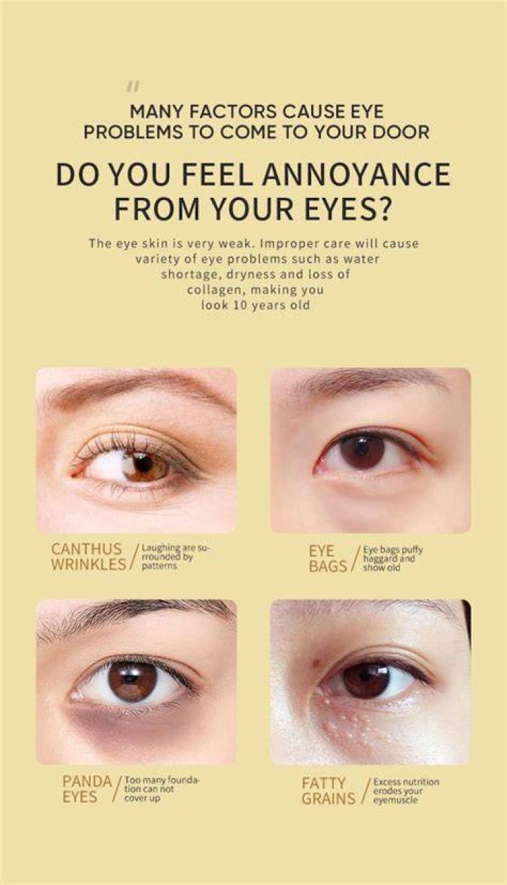 3 Areas & Under Eye (Jelly Roll) Anti Wrinkle (Botox) Before, During