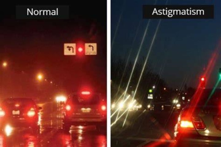 A Complete Guide to Astigmatism Symptoms, Causes.