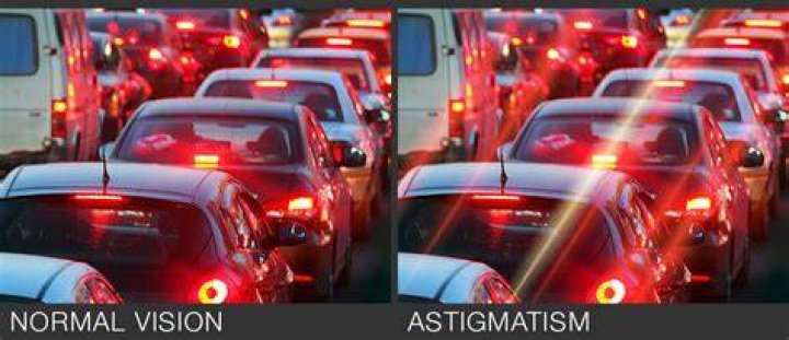 Astigmatism causes Blurred Vision First Eye Care Downtown Dallas