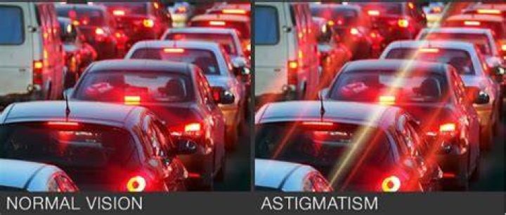 Astigmatism Vs No Astigmatism Lights Astigmatism Swollen
