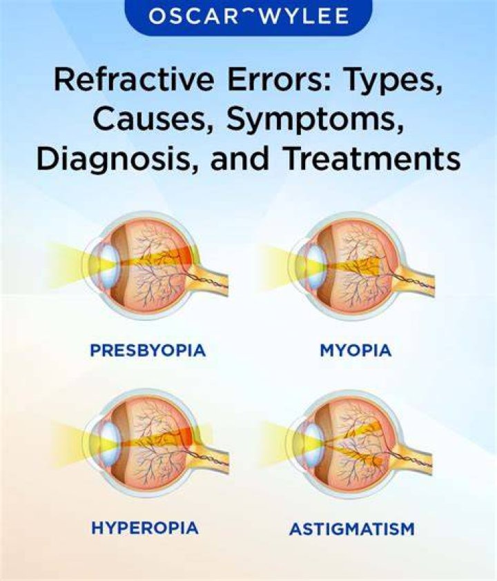 AstigmatismCausesTypesSymptomsTreatment Lenses, Refractive Surgery