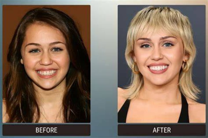 Before & After's