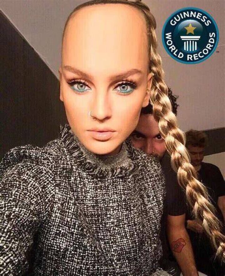 Biggest forehead in the world woahdude