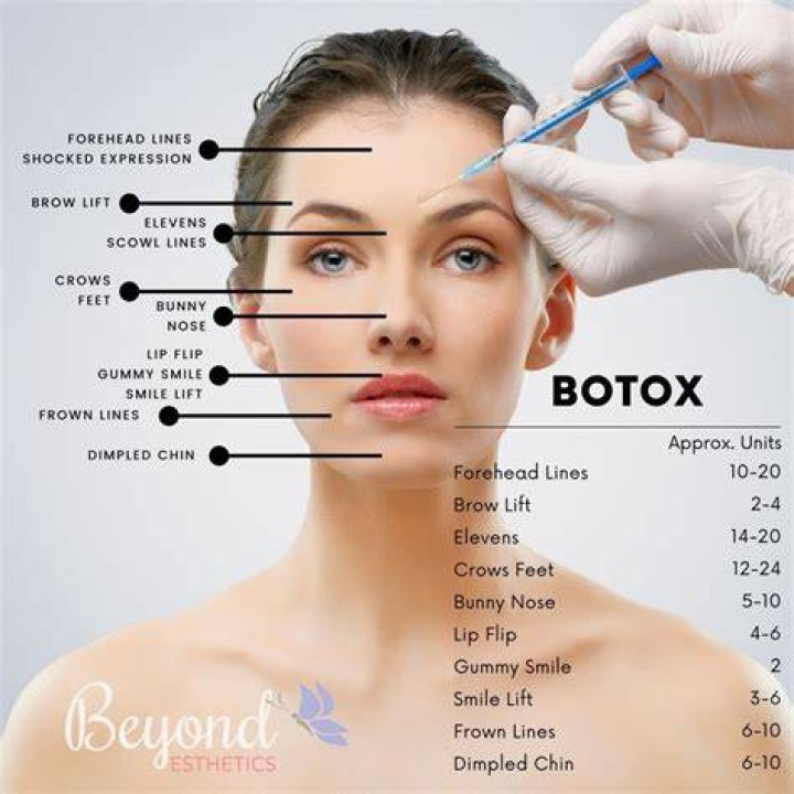 Botox Facial, Botox Lips, Facial Contouring, Cheek Fillers, Botox