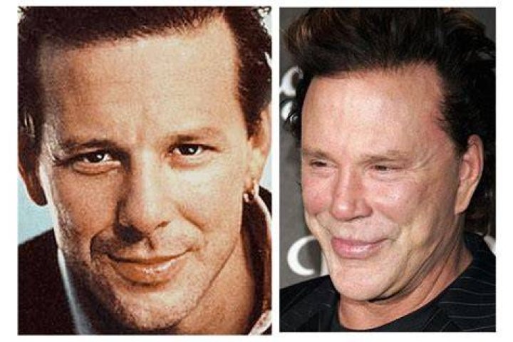 Celebrity Head Transplants HuffPost