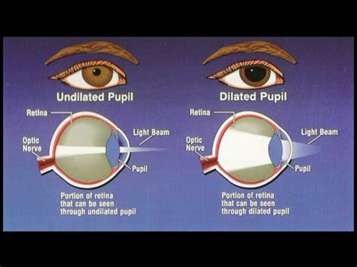 Eyeopening pictures shine light on symptoms of astigmatism CTV News