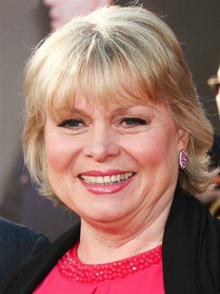 How Did Julie Dawn Cole Get Her Scar?