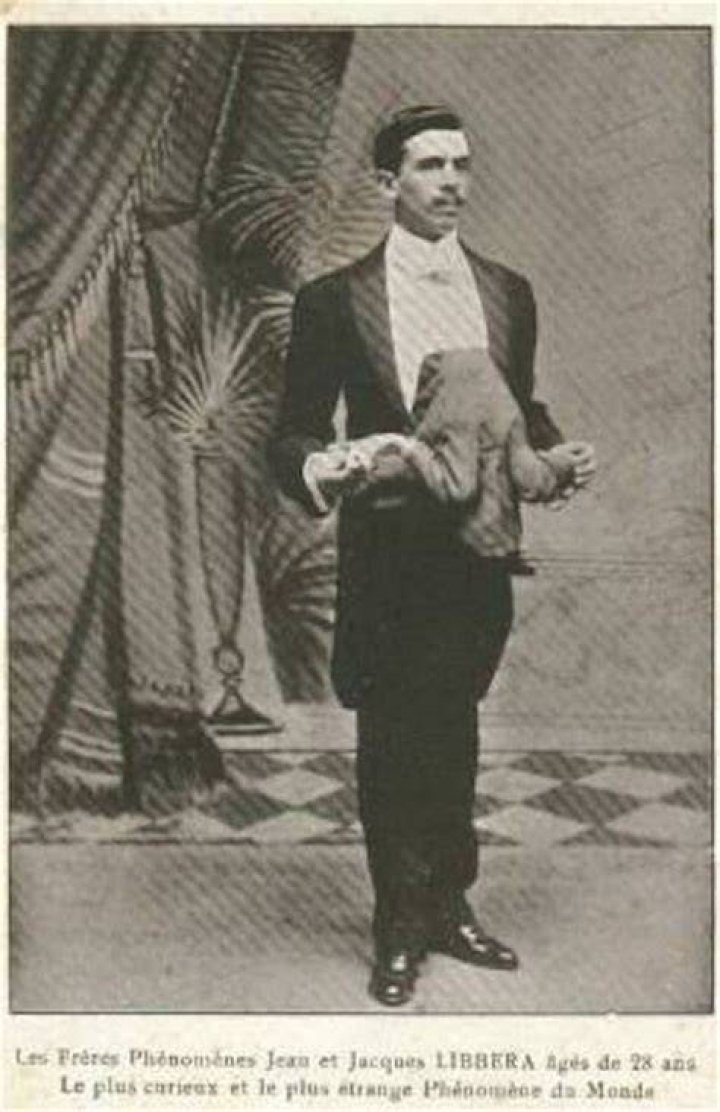 Jean Libbera Wikipedia Bio Who Was He? XRay Photos