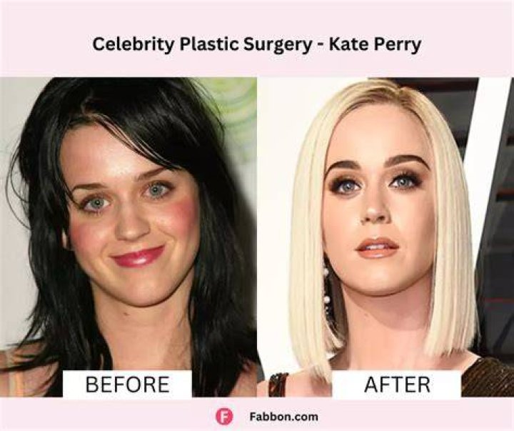 Jonna Walsh Before Plastic Surgery Facelift, Body Measurements, Nose