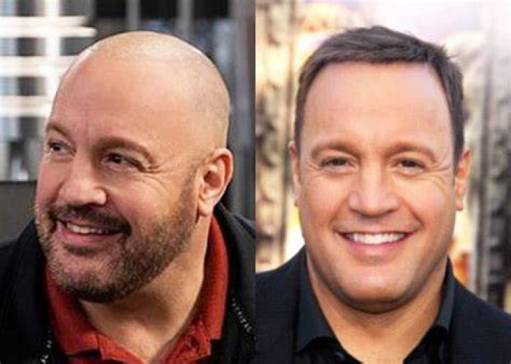 Kevin James Toupee Did He Wear A Hairpiece On King Of Queens?