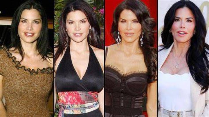 Lauren Sanchez Before and After Plastic Surgery Botox, Body