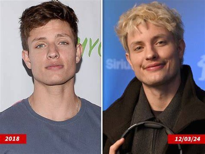 Matt Rife Plastic Surgery & Weight Loss. Glow Up And Before After Pictures.