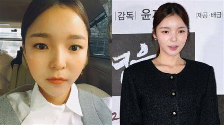 Park Jin Joo Plastic Surgery What Is Her Secret of Beauty?