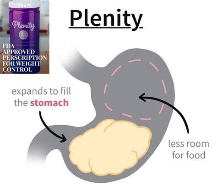 Plenity A New Weight Loss Pill ScienceBased Medicine