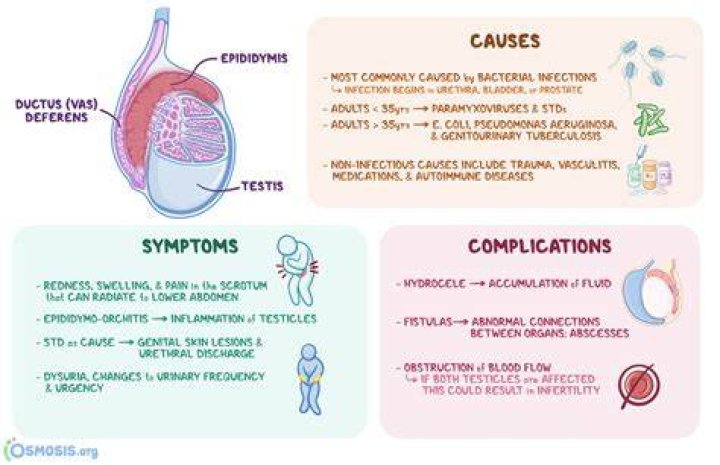 Testicular pain causes, diagnosis and testicle pain treatment