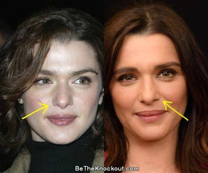Uncover The Secrets Of Rachel Weisz's Enchanting Nose