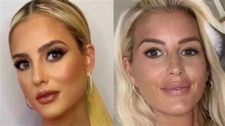 Unveiling Emma Hernan's Plastic Surgery Journey: Secrets Revealed