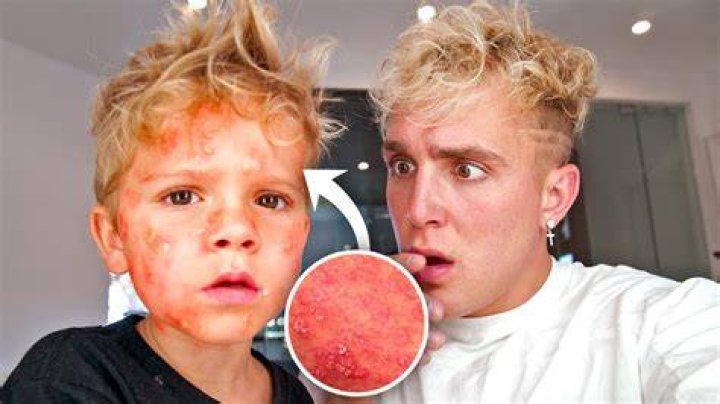 We had to take Tydus to the hospital.. YouTube Music