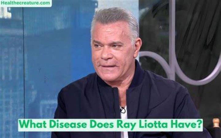 What Disease Does Ray Liotta Have X03a5inhgpafhm Habib Montgomery