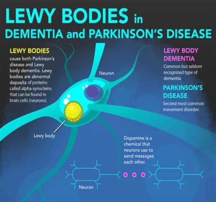 What is Lewy Bodies Dementia, the condition Robin Williams was