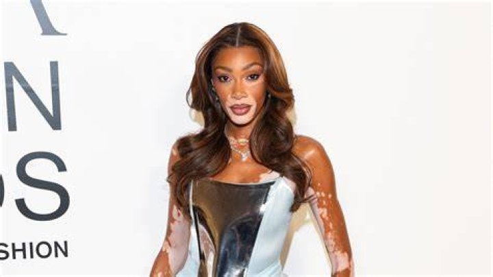 Winnie Harlow Net Worth 2020 The Washington Note